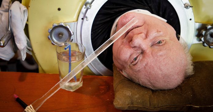 Paul Alexander, Polio Survivor Who Lived in Iron Lung for 72 Years, Dies age 78